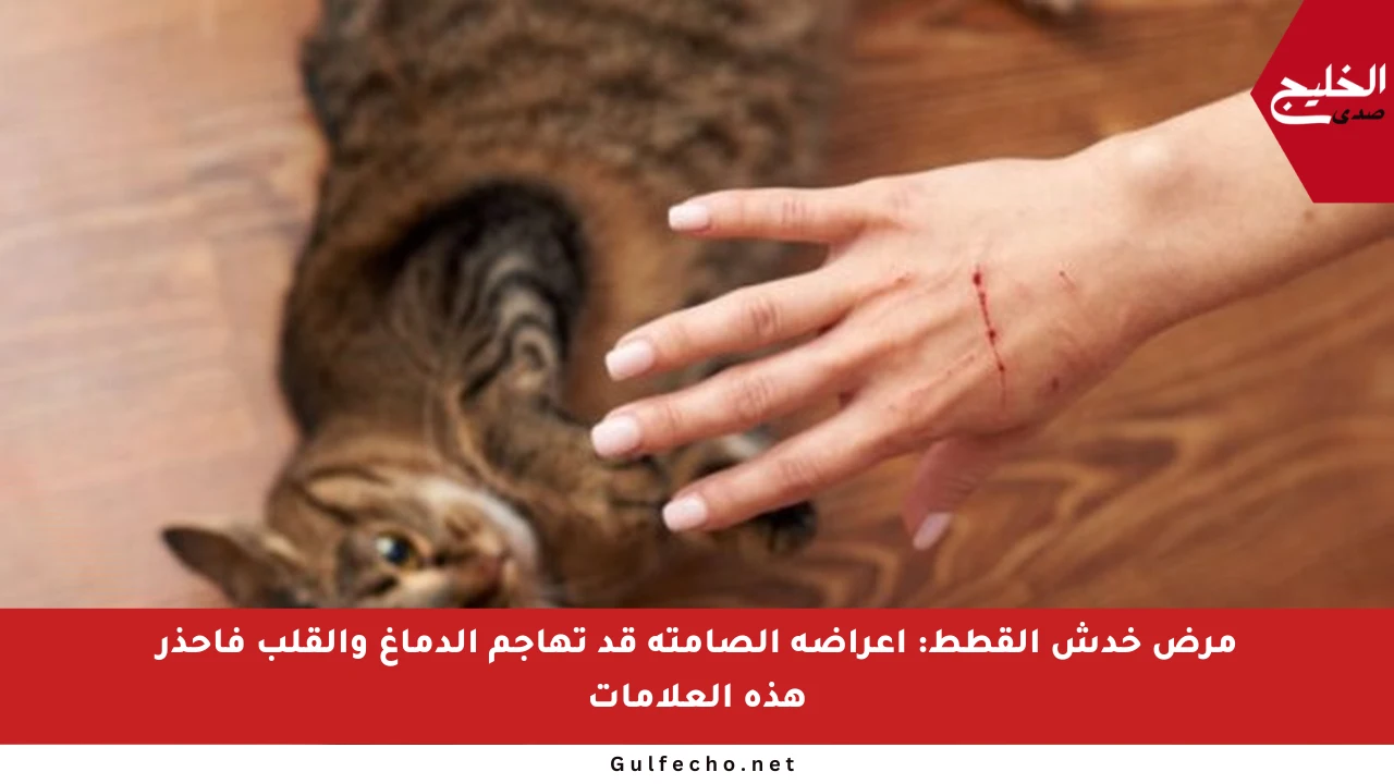 مرض خدش القطط: أعراضه الصامتة قد تهاجم الدماغ والقلب فاحذر هذه العلامات